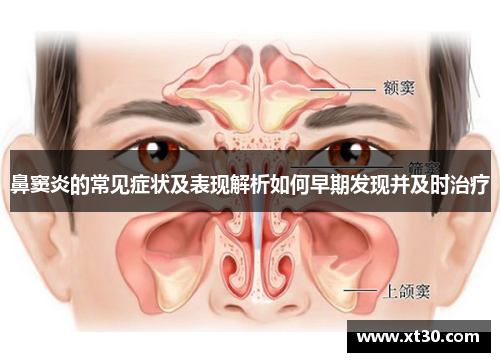 鼻窦炎的常见症状及表现解析如何早期发现并及时治疗
